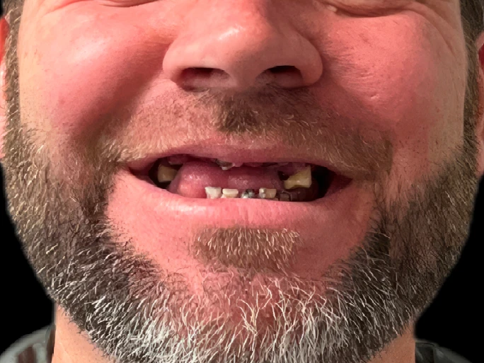 8Before