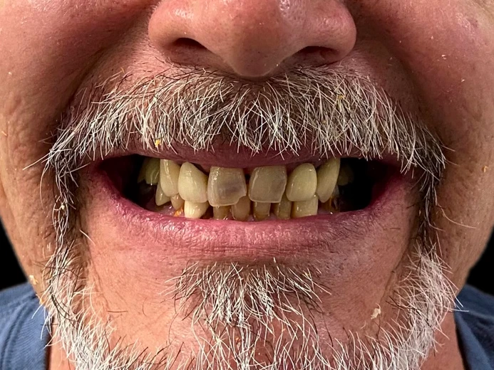 9Before