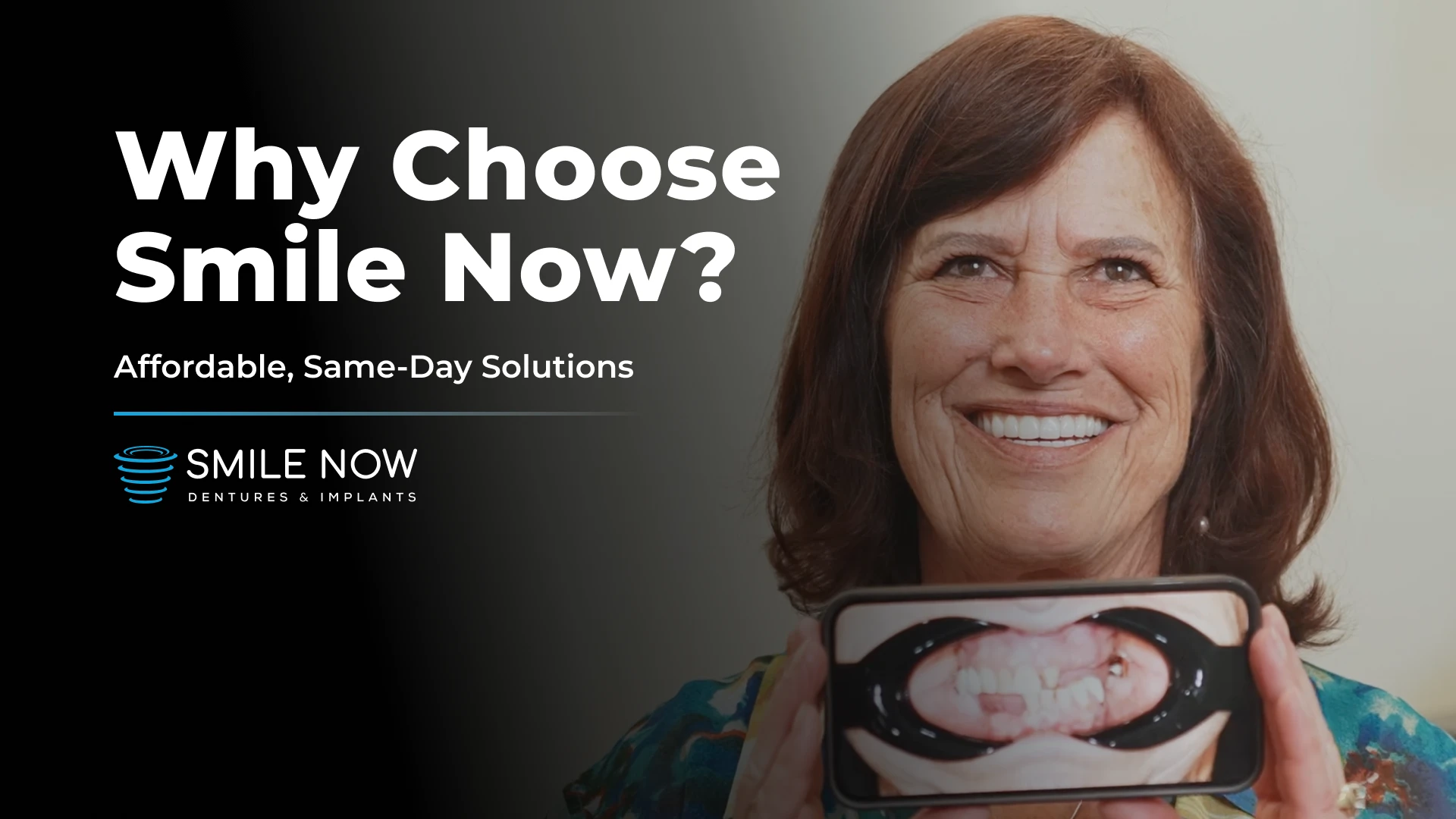 Why Choose Smile Now Dentures & Implants? Affordable, Same-Day Dental Implant Solutions